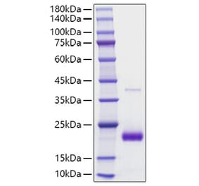 SDS-PAGE - Recombinant human SECTM1 Protein (C-terminal His Tag) (A331244) - Antibodies.com