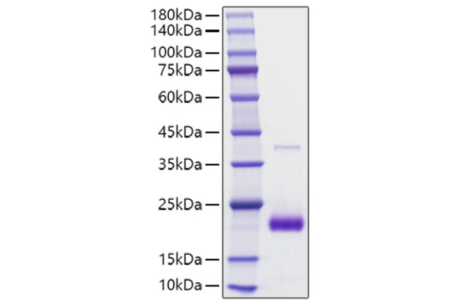 SDS-PAGE - Recombinant human SECTM1 Protein (C-terminal His Tag) (A331244) - Antibodies.com