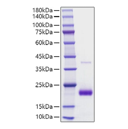 SDS-PAGE - Recombinant human SECTM1 Protein (C-terminal His Tag) (A331244) - Antibodies.com