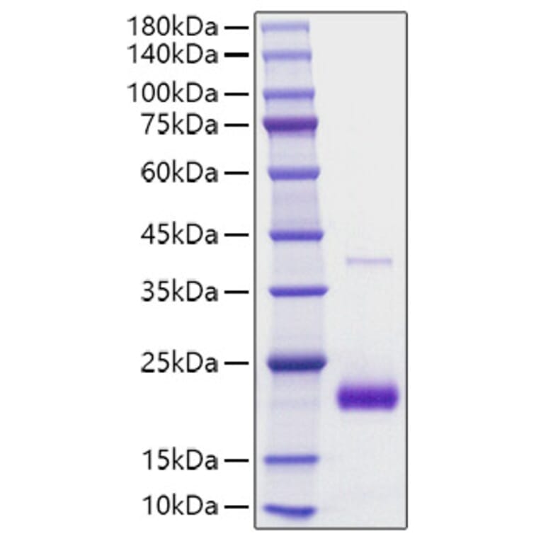 SDS-PAGE - Recombinant human SECTM1 Protein (C-terminal His Tag) (A331244) - Antibodies.com