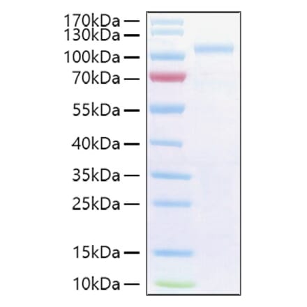 SDS-PAGE - Recombinant Human SEMA3G Protein (C-terminal His Tag) (A331245) - Antibodies.com
