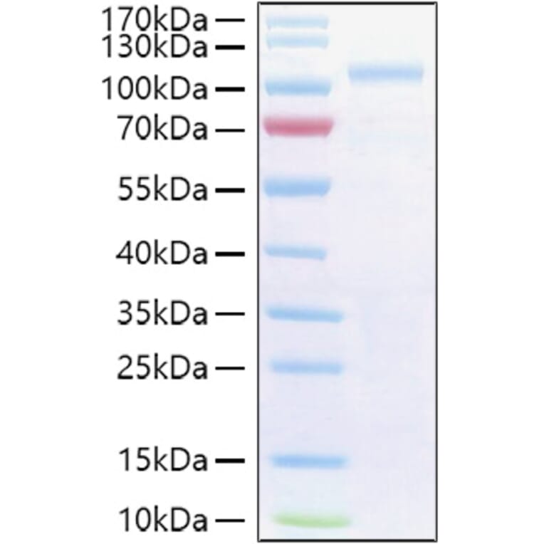 SDS-PAGE - Recombinant Human SEMA3G Protein (C-terminal His Tag) (A331245) - Antibodies.com