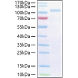 SDS-PAGE - Recombinant Human SEMA3G Protein (C-terminal His Tag) (A331245) - Antibodies.com