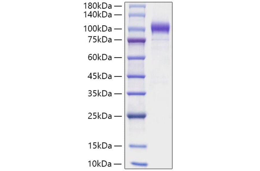 SDS-PAGE - Recombinant Human SEMA6A Protein (C-terminal His Tag) (A331247) - Antibodies.com