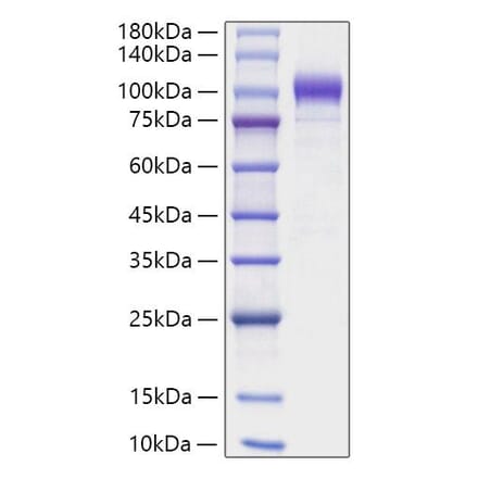 SDS-PAGE - Recombinant Human SEMA6A Protein (C-terminal His Tag) (A331247) - Antibodies.com