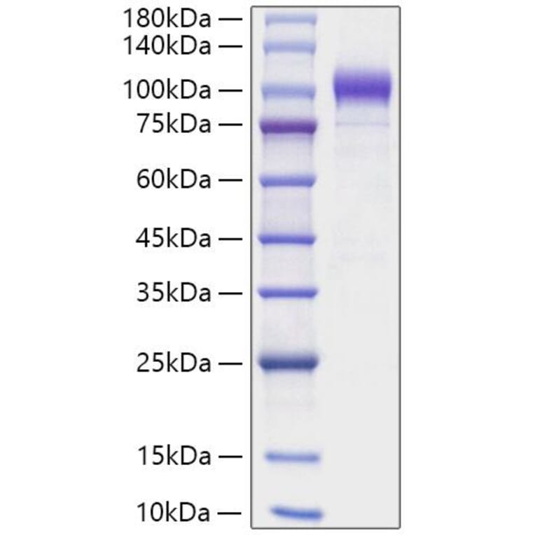 SDS-PAGE - Recombinant Human SEMA6A Protein (C-terminal His Tag) (A331247) - Antibodies.com