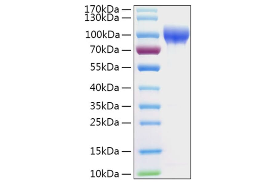 SDS-PAGE - Recombinant Human SERPING1 Protein (C-terminal His Tag) (A331249) - Antibodies.com