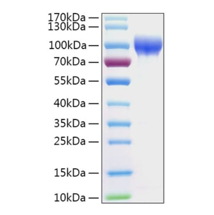 SDS-PAGE - Recombinant Human SERPING1 Protein (C-terminal His Tag) (A331249) - Antibodies.com