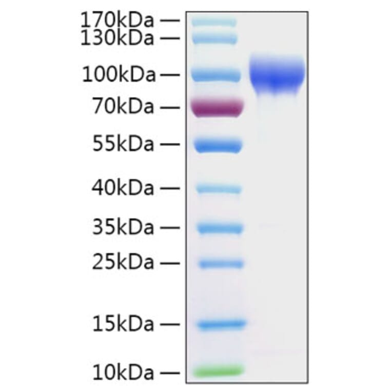 SDS-PAGE - Recombinant Human SERPING1 Protein (C-terminal His Tag) (A331249) - Antibodies.com