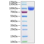 SDS-PAGE - Recombinant Human SERPING1 Protein (C-terminal His Tag) (A331249) - Antibodies.com