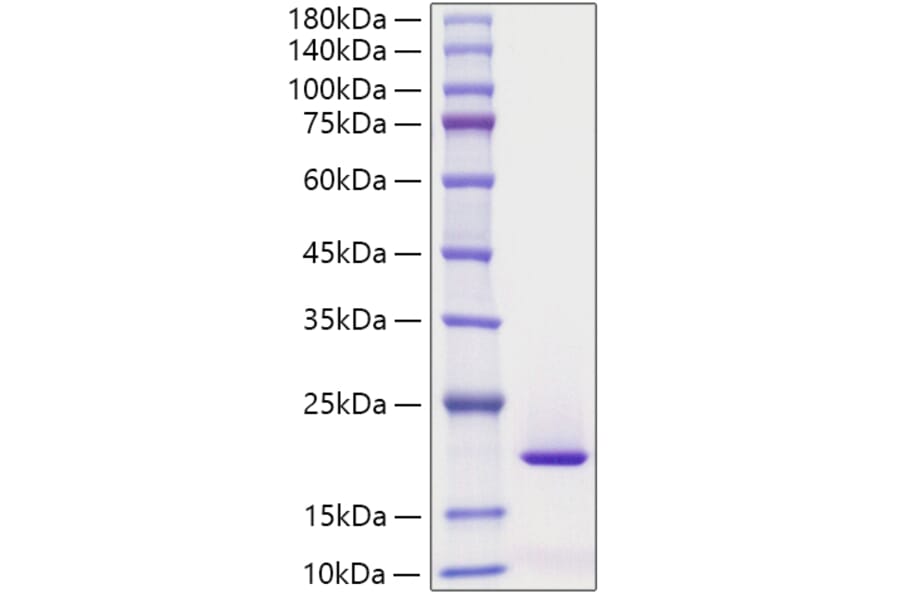 SDS-PAGE - Recombinant Human SF20 Protein (C-terminal His Tag) (A331251) - Antibodies.com