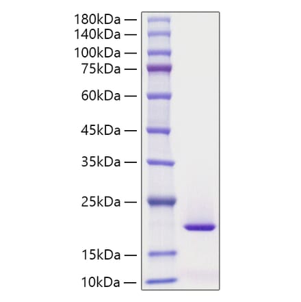 SDS-PAGE - Recombinant Human SF20 Protein (C-terminal His Tag) (A331251) - Antibodies.com