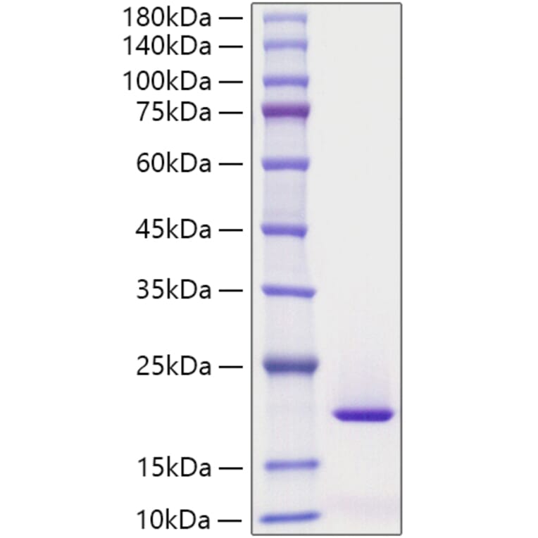 SDS-PAGE - Recombinant Human SF20 Protein (C-terminal His Tag) (A331251) - Antibodies.com