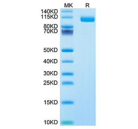 Tris-Bis PAGE - Recombinant Human SIGLEC10 Protein (Biotin) (C-terminal Human Fc and Avi Tag) (A331252) - Antibodies.com