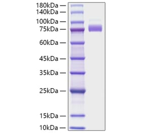 SDS-PAGE - Recombinant Human SIGLEC10 Protein (C-terminal His Tag) (A331253) - Antibodies.com
