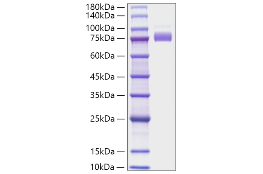 SDS-PAGE - Recombinant Human SIGLEC10 Protein (C-terminal His Tag) (A331253) - Antibodies.com