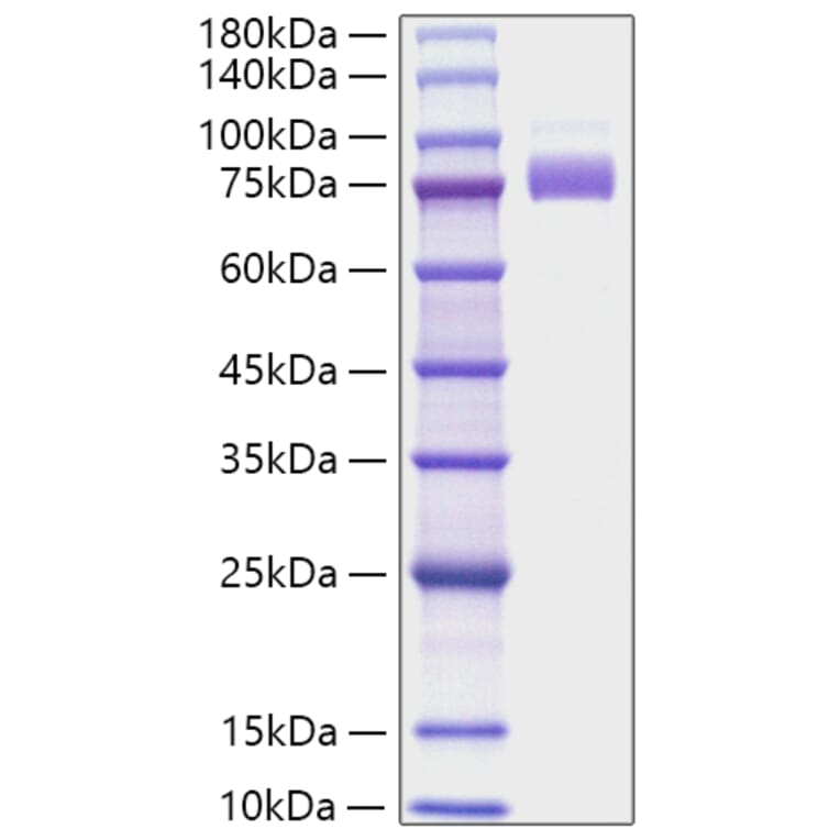 SDS-PAGE - Recombinant Human SIGLEC10 Protein (C-terminal His Tag) (A331253) - Antibodies.com
