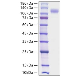 SDS-PAGE - Recombinant Human SIGLEC10 Protein (C-terminal Human Fc Tag) (A331254) - Antibodies.com