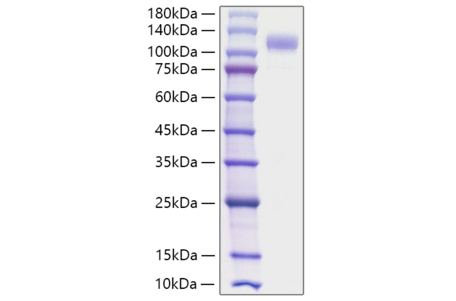 SDS-PAGE - Recombinant Human SIGLEC10 Protein (C-terminal Human Fc Tag) (A331254) - Antibodies.com