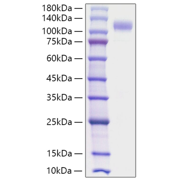 SDS-PAGE - Recombinant Human SIGLEC10 Protein (C-terminal Human Fc Tag) (A331254) - Antibodies.com