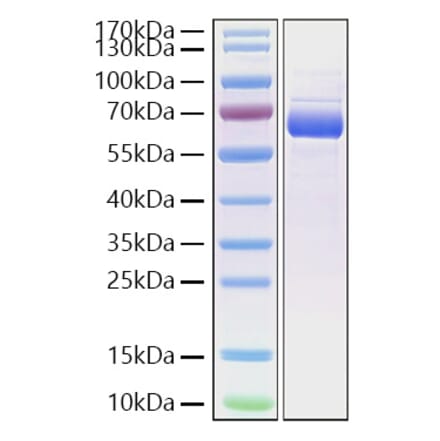 SDS-PAGE - Recombinant Cynomolgus macaque SIGLEC15 Protein (C-terminal Human Fc and His Tag) (A331256) - Antibodies.com