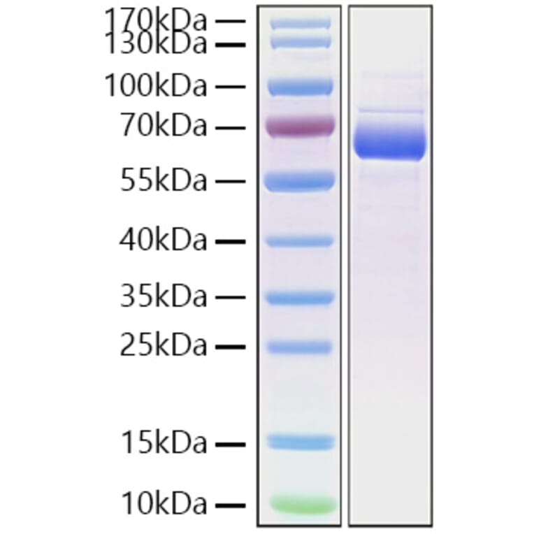 SDS-PAGE - Recombinant Cynomolgus macaque SIGLEC15 Protein (C-terminal Human Fc and His Tag) (A331256) - Antibodies.com