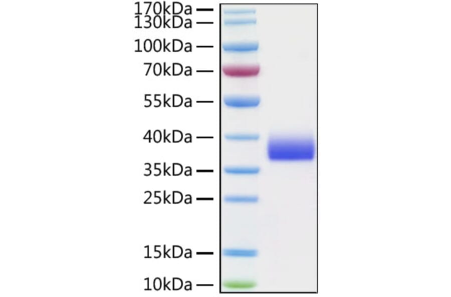 SDS-PAGE - Recombinant Cynomolgus macaque SIGLEC15 Protein (C-terminal His Tag) (A331257) - Antibodies.com