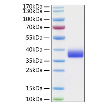 SDS-PAGE - Recombinant Cynomolgus macaque SIGLEC15 Protein (C-terminal His Tag) (A331257) - Antibodies.com