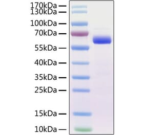 SDS-PAGE - Recombinant Mouse SIGLEC15 Protein (C-terminal Human Fc Tag) (A331258) - Antibodies.com
