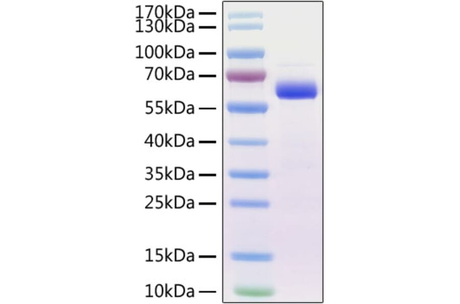 SDS-PAGE - Recombinant Mouse SIGLEC15 Protein (C-terminal Human Fc Tag) (A331258) - Antibodies.com