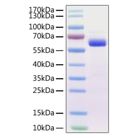 SDS-PAGE - Recombinant Mouse SIGLEC15 Protein (C-terminal Human Fc Tag) (A331258) - Antibodies.com