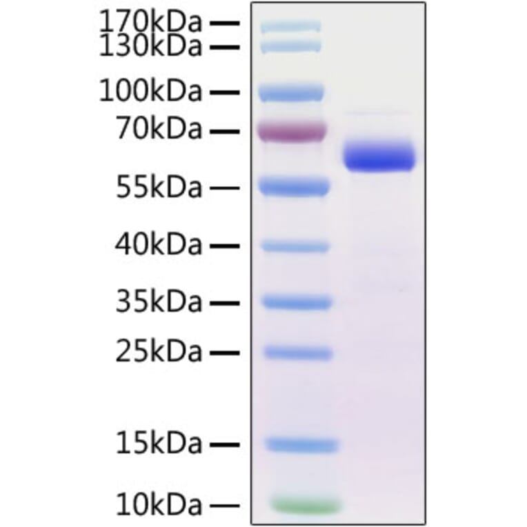 SDS-PAGE - Recombinant Mouse SIGLEC15 Protein (C-terminal Human Fc Tag) (A331258) - Antibodies.com
