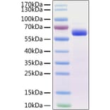SDS-PAGE - Recombinant Mouse SIGLEC15 Protein (C-terminal Human Fc Tag) (A331258) - Antibodies.com