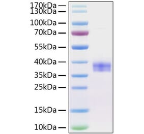 SDS-PAGE - Recombinant Mouse SIGLEC15 Protein (C-terminal His Tag) (A331259) - Antibodies.com