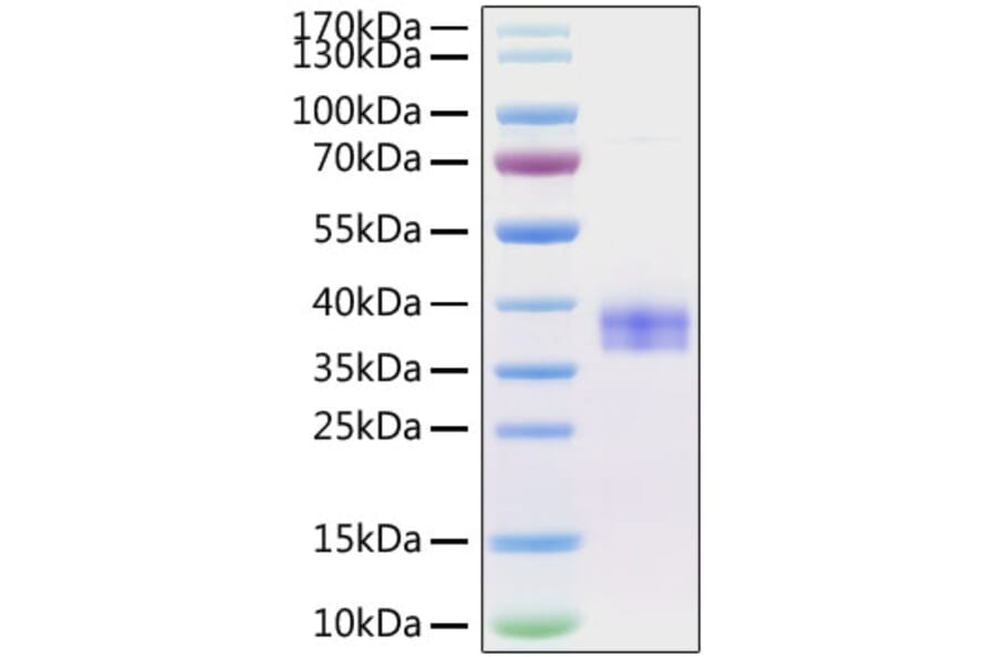 SDS-PAGE - Recombinant Mouse SIGLEC15 Protein (C-terminal His Tag) (A331259) - Antibodies.com