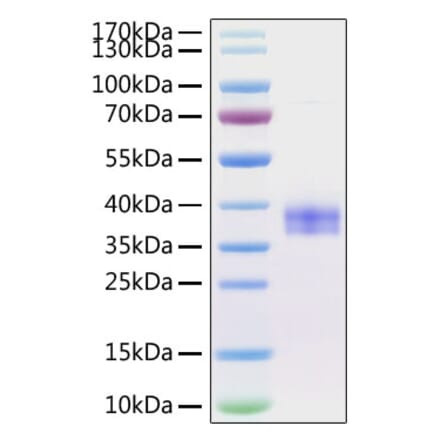 SDS-PAGE - Recombinant Mouse SIGLEC15 Protein (C-terminal His Tag) (A331259) - Antibodies.com
