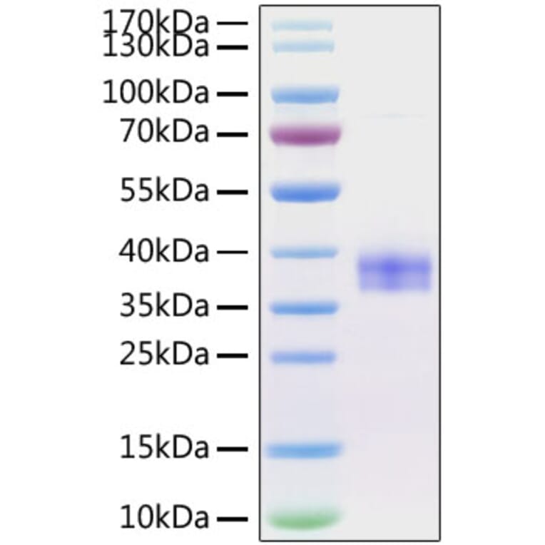 SDS-PAGE - Recombinant Mouse SIGLEC15 Protein (C-terminal His Tag) (A331259) - Antibodies.com