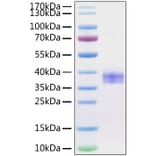 SDS-PAGE - Recombinant Mouse SIGLEC15 Protein (C-terminal His Tag) (A331259) - Antibodies.com