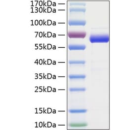 SDS-PAGE - Recombinant Human SIGLEC15 Protein (C-terminal Human Fc and His Tag) (A331260) - Antibodies.com