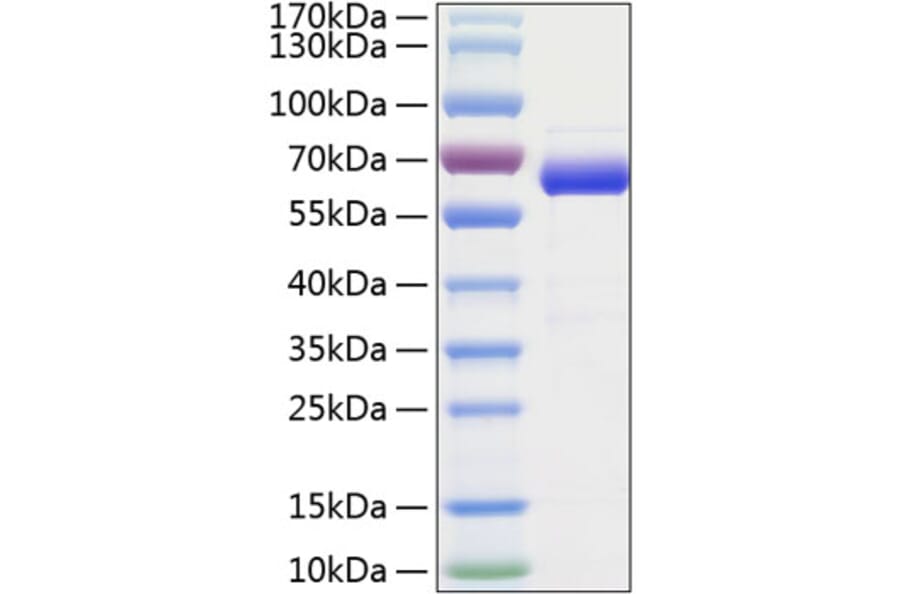 SDS-PAGE - Recombinant Human SIGLEC15 Protein (C-terminal Human Fc and His Tag) (A331260) - Antibodies.com