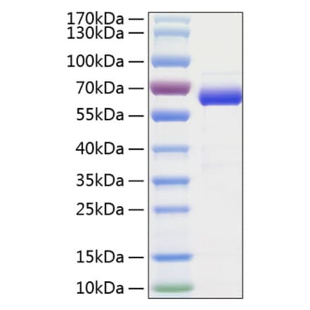 SDS-PAGE - Recombinant Human SIGLEC15 Protein (C-terminal Human Fc and His Tag) (A331260) - Antibodies.com