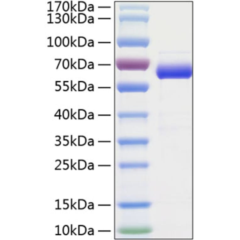 SDS-PAGE - Recombinant Human SIGLEC15 Protein (C-terminal Human Fc and His Tag) (A331260) - Antibodies.com