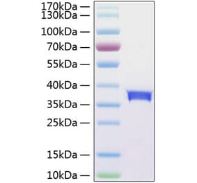 SDS-PAGE - Recombinant Human SIGLEC15 Protein (C-terminal His Tag) (A331261) - Antibodies.com