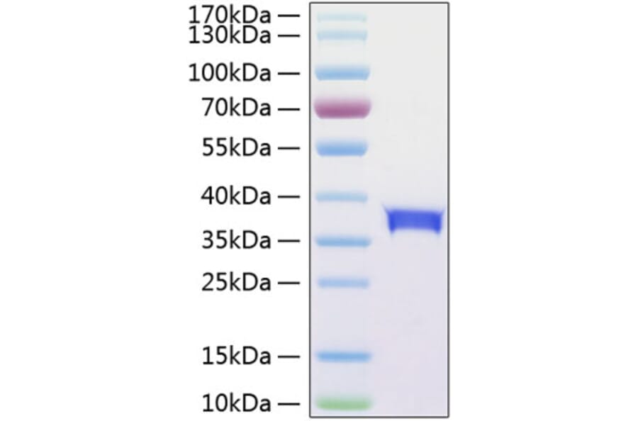 SDS-PAGE - Recombinant Human SIGLEC15 Protein (C-terminal His Tag) (A331261) - Antibodies.com