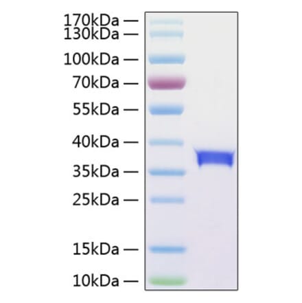 SDS-PAGE - Recombinant Human SIGLEC15 Protein (C-terminal His Tag) (A331261) - Antibodies.com