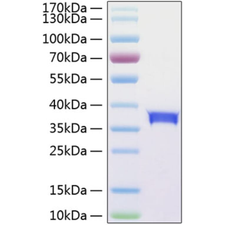 SDS-PAGE - Recombinant Human SIGLEC15 Protein (C-terminal His Tag) (A331261) - Antibodies.com