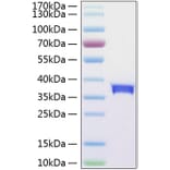 SDS-PAGE - Recombinant Human SIGLEC15 Protein (C-terminal His Tag) (A331261) - Antibodies.com