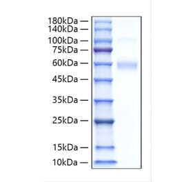 SDS-PAGE - Recombinant Human SIGLEC5 Protein (C-terminal His Tag) (A331264) - Antibodies.com