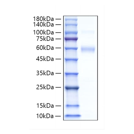 SDS-PAGE - Recombinant Human SIGLEC5 Protein (C-terminal His Tag) (A331264) - Antibodies.com