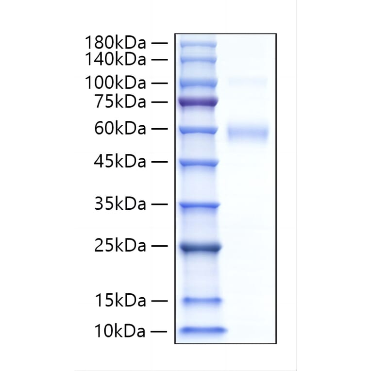 SDS-PAGE - Recombinant Human SIGLEC5 Protein (C-terminal His Tag) (A331264) - Antibodies.com